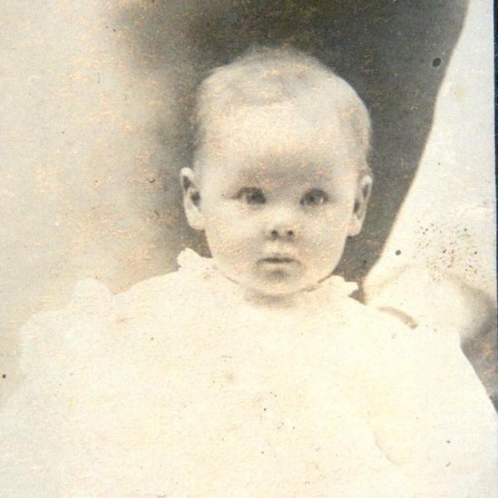 Born With a Rare Condition