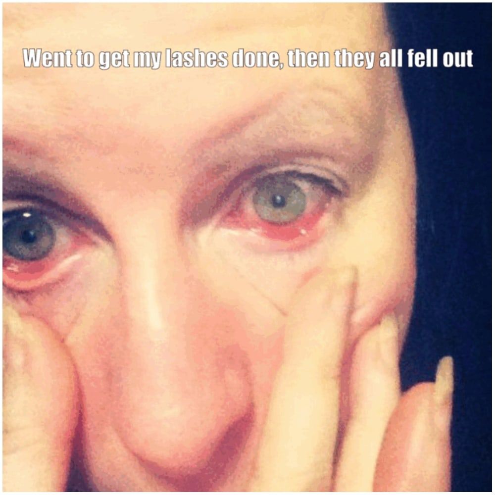 Promise to Patch Test