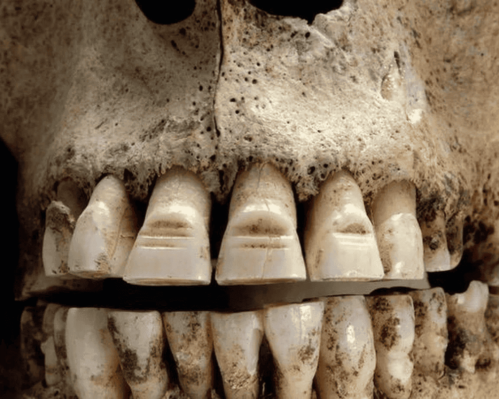 Some Vikings Filed Their Teeth