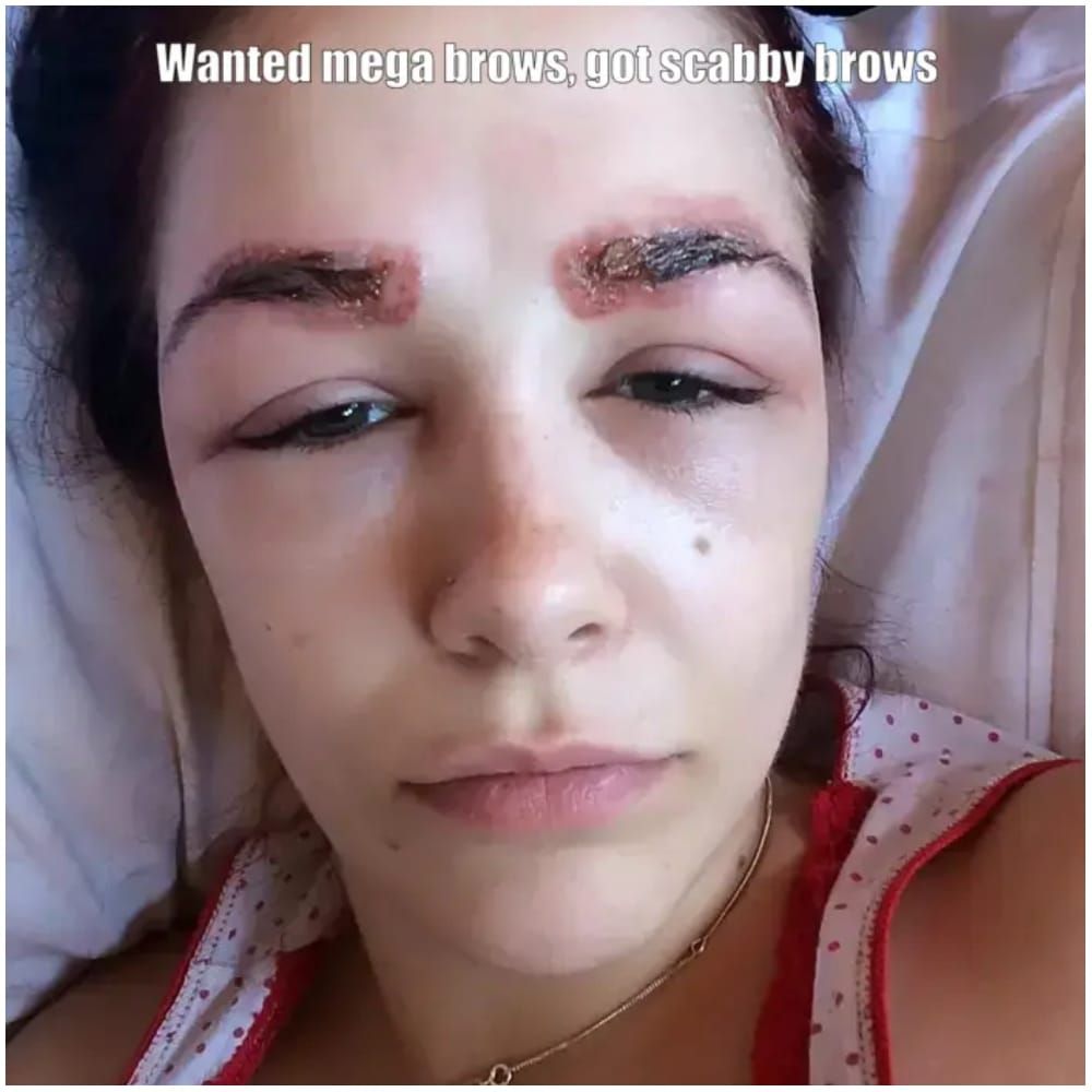 Scars and Scabbing