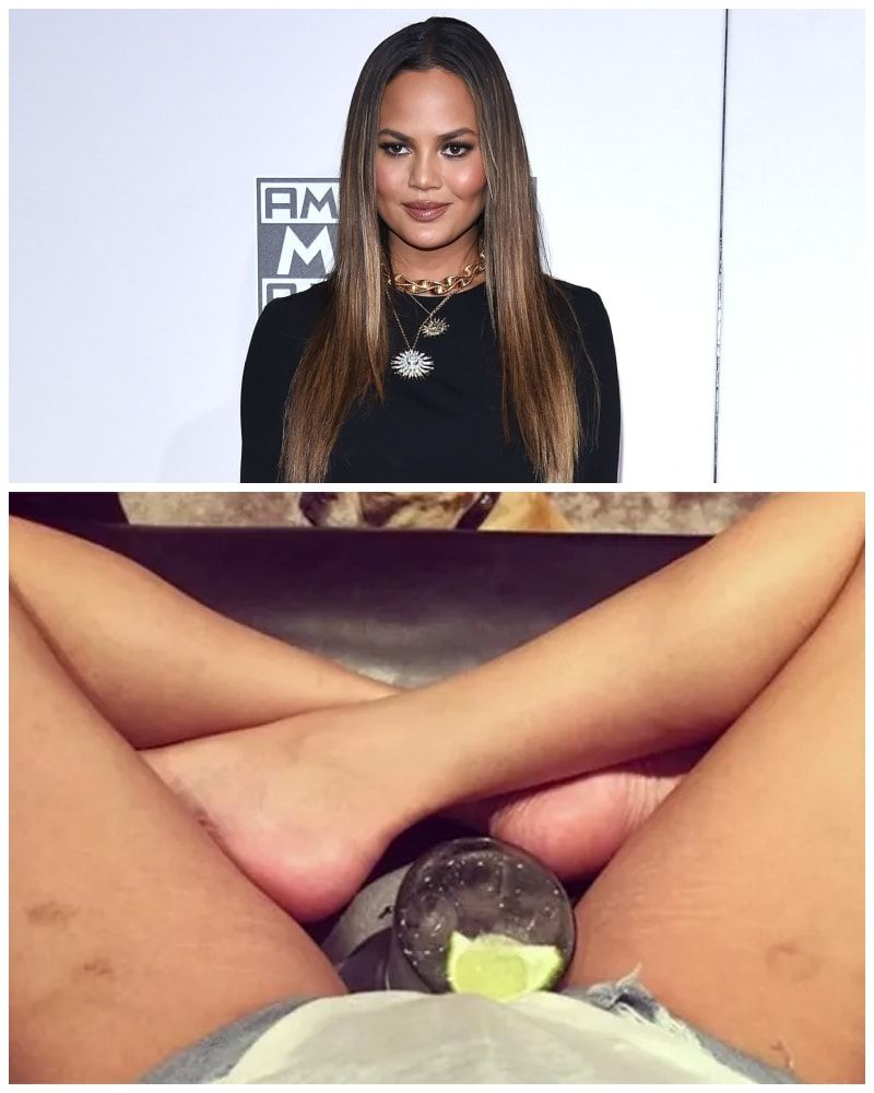 Chrissy Teigen