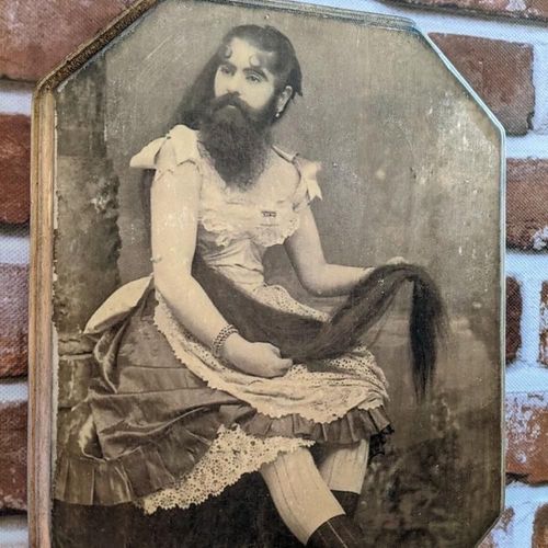 The Sad Story of the Real-Life 'Bearded Woman'