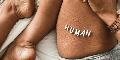 30+ Women Post Unedited Pics to Normalize Normal Bodies